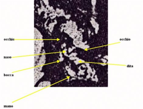 Parti Anatomiche della Larva Medianica