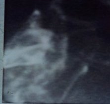 Larve sul Luogo dell'Incidente - 5